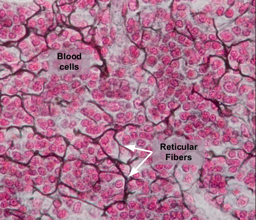 <p>spleen, bone marrow, and lymph nodes </p>
