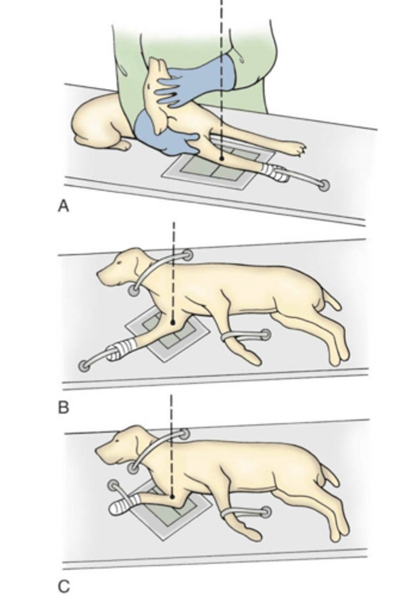 <p>what positioning is involved in RADs for FCP</p>