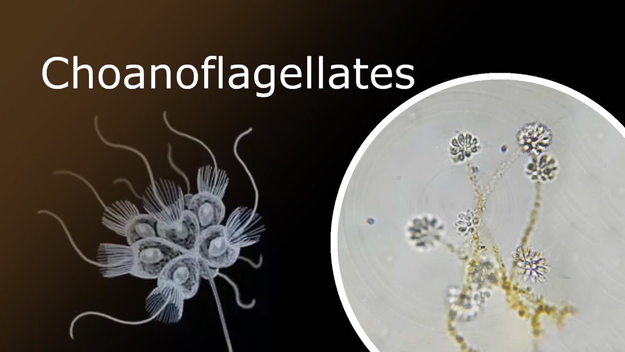 <p>Colonial choanoflagellates </p><p>(These resemble the choanocytes, or goblet cells, found in sponges.)</p>