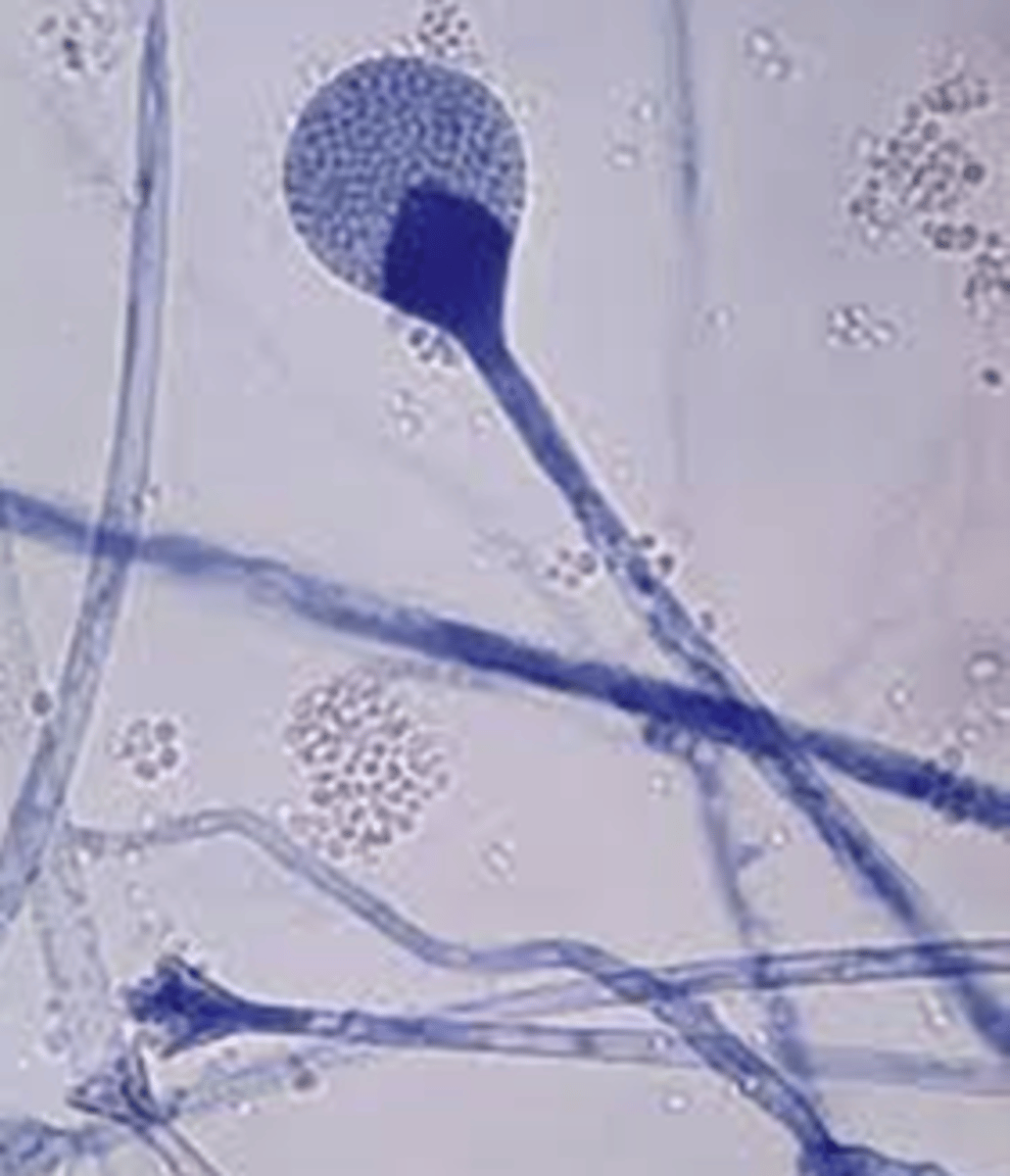 <p>No rhizoids</p><p>• Sporangia fall apart</p><p>easily</p>