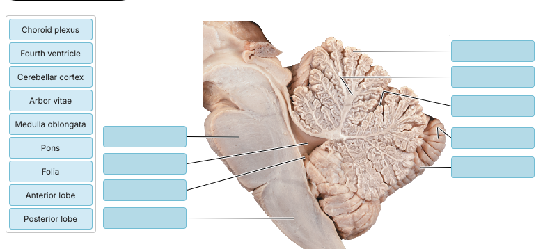 <p>Match the following </p>