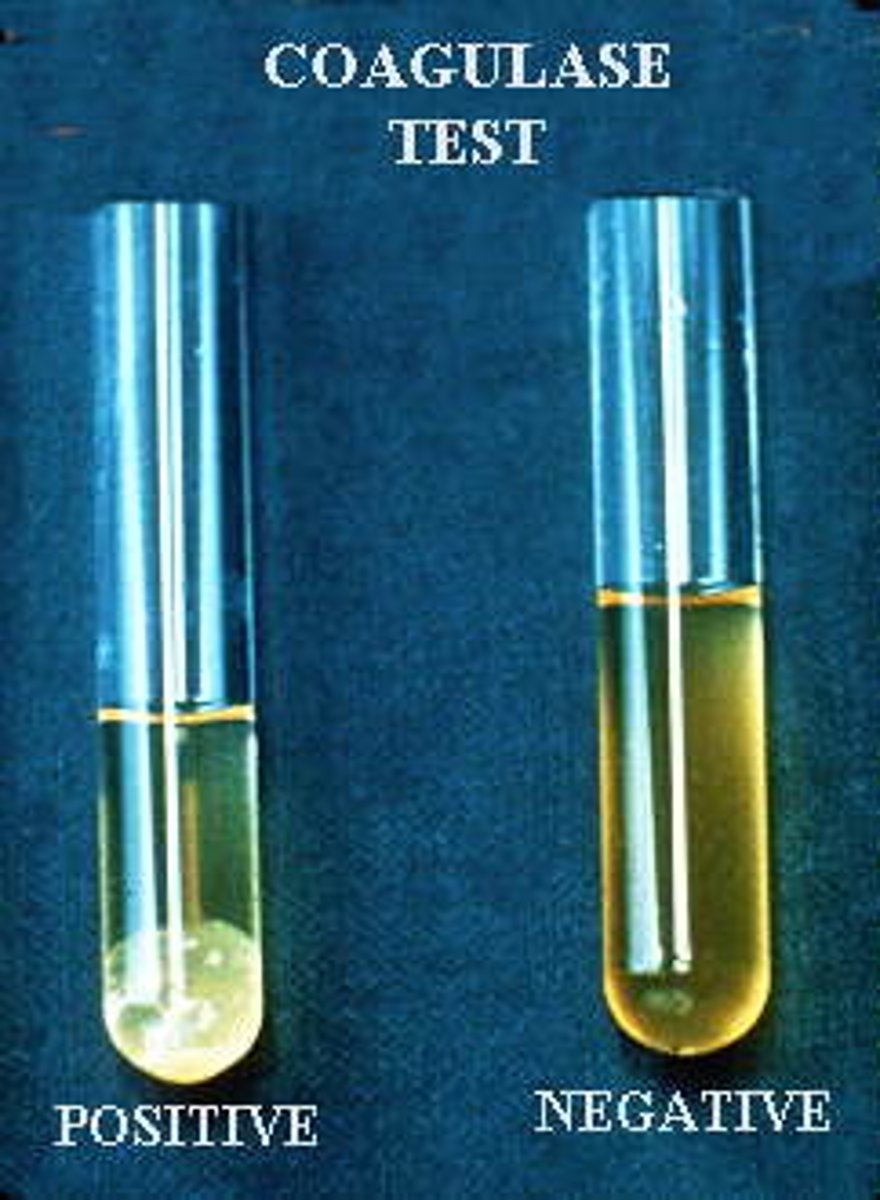 <p>bacterial enzyme that aids in clotting to protect bacteria from immune system responses</p>