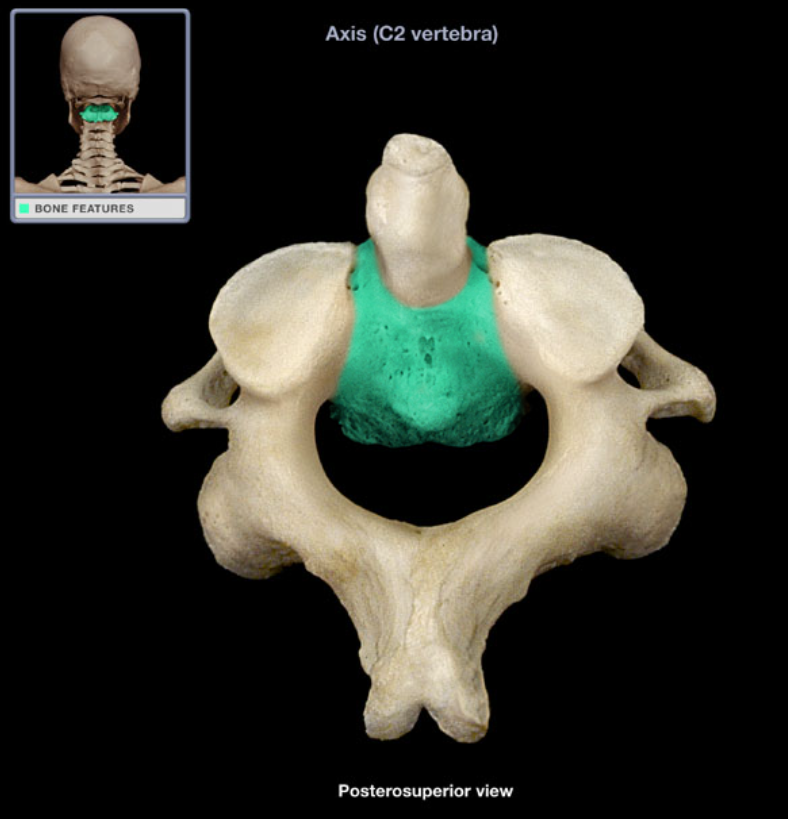 <ul><li><p>Location: Axis (anterior aspect)</p></li><li><p>Description: Has superior projection (dens), Attached to pedicle on either side, Separated from body of C3 by intervertebral disc</p></li></ul><p></p>