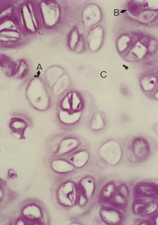<p>What type of cartilage is this?</p>