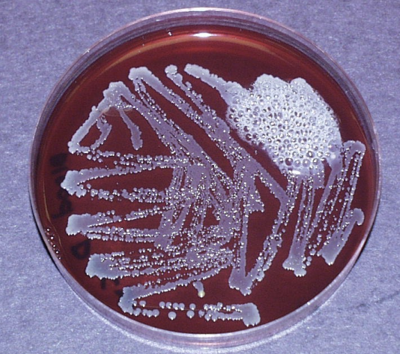 <p>bubbling</p>