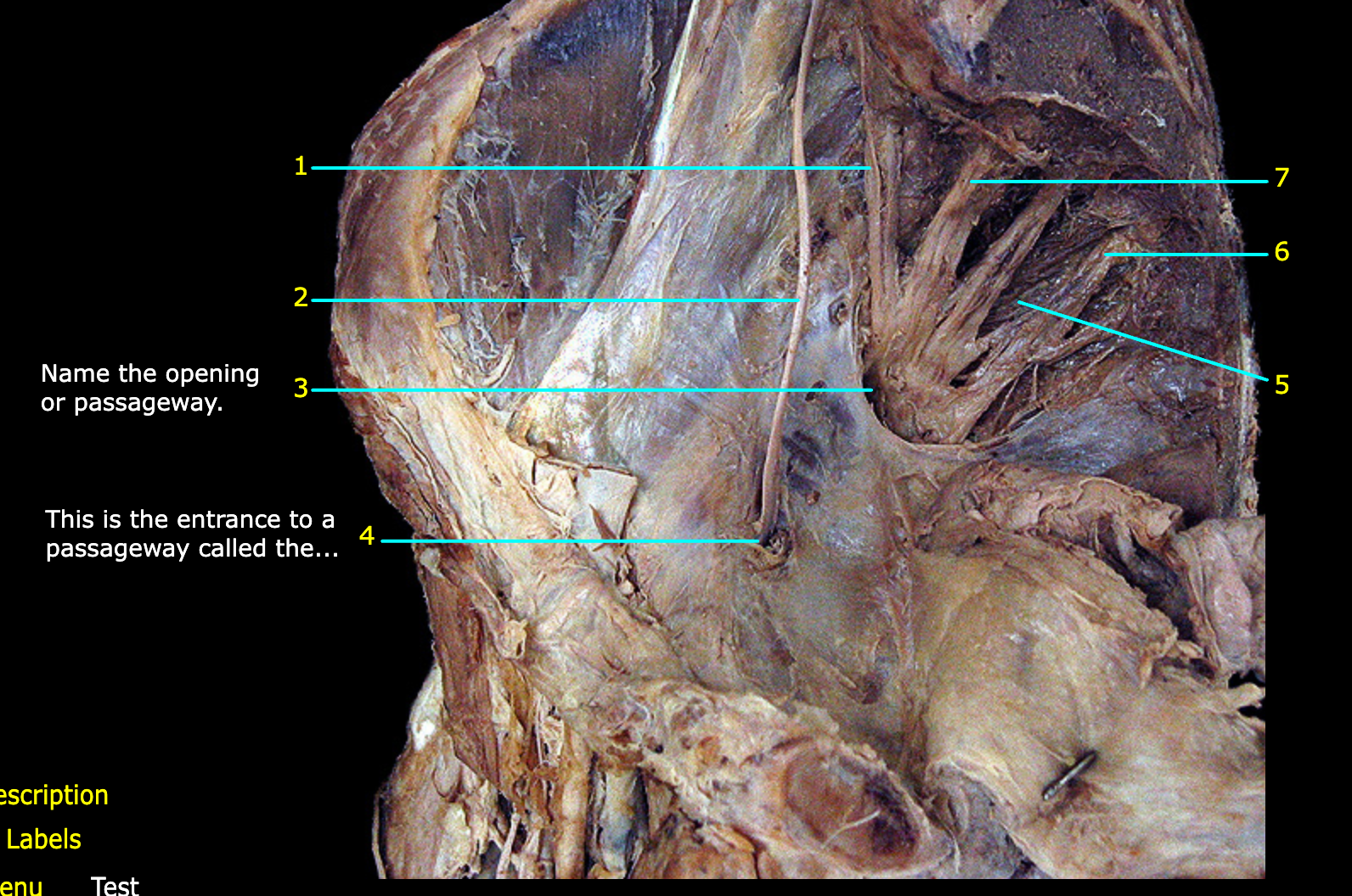 <p>What structure is labeled 2?</p>