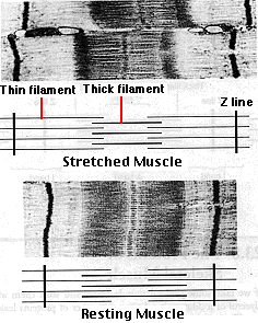 <ul><li><p>Z lines come closer together</p></li><li><p>width of the I bands decreases</p></li><li><p>width of the H zones decreases</p></li><li><p>there is NO change in the width of the A band</p></li></ul><p></p>