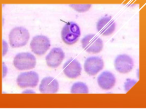 <p>What does Babesia spp.: B. canis, B. gibsoni, B. bovis cause?</p>