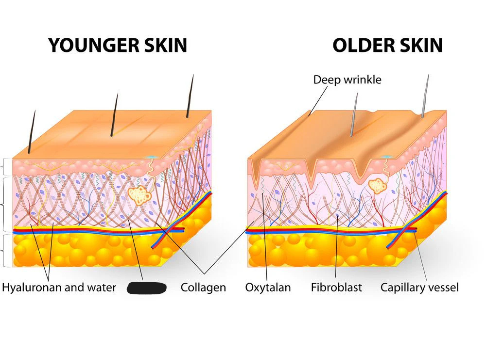 <p><span style="background-color: transparent;"><span>A highly elastic connective tissue allowing many tissues to retain their shape.</span></span></p>