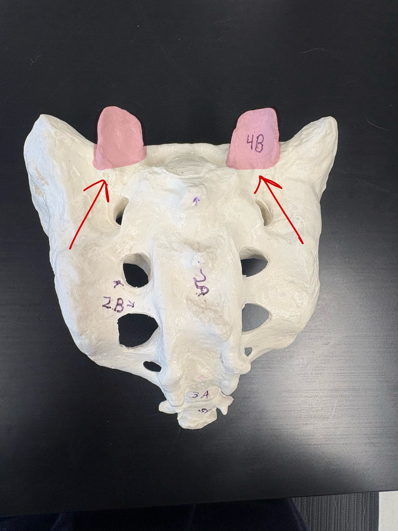 <p>Name this structure</p>