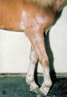 <p>ขาไม่สามารถรับน้ำหนักได้(ยืนไม่ได้) เพราะเป็นเส้นประสาทที่ควบคุมกล้ามเนื้อ extensor ทุกมัด, Knuckled</p>