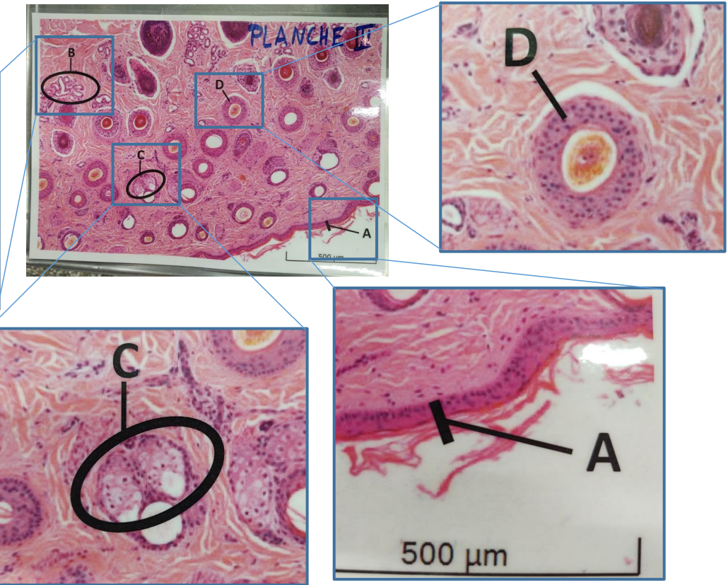 <p>Epidermis</p>