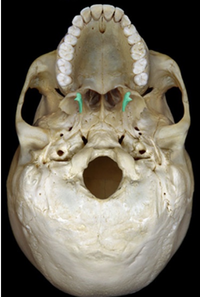 <p>Identify the bone.</p>