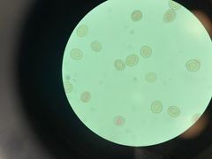 <p>What is the genus species of these tapeworm eggs? It is the most common Taenia species in dogs in Alberta</p>