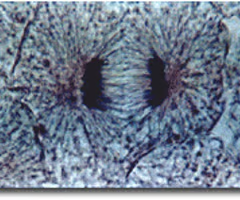 <p>the third phase of mitosis, during which the chromosome pairs separate and move toward opposite poles</p>