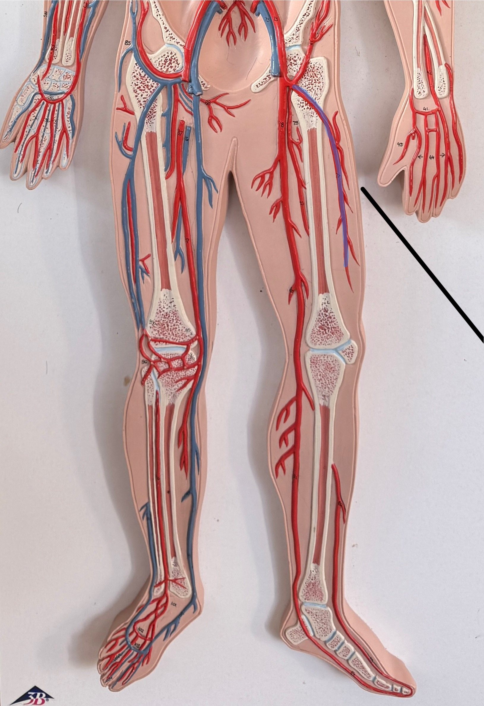 <p>Name this artery.</p>