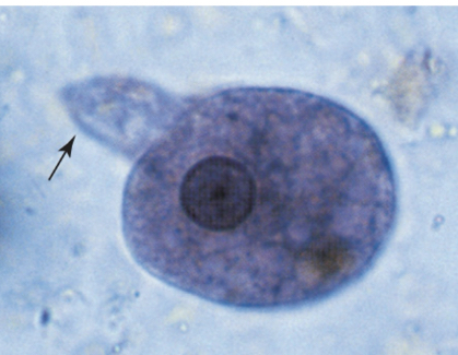 <p>Entamoeba hartmanni cyst</p>
