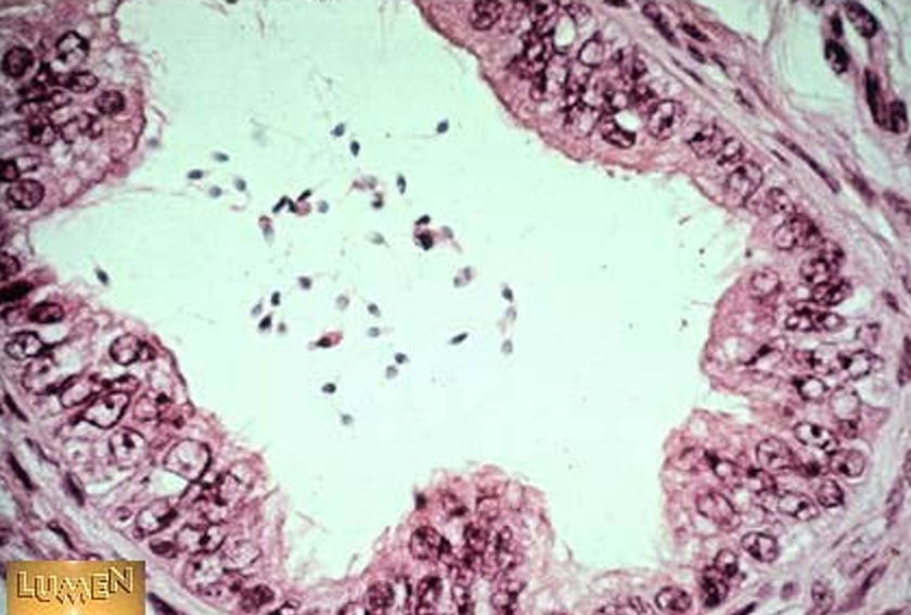 <p class=""><strong>ductuli efferentes</strong></p><ul><li><p class=""><strong>Wavy or scalloped lumen</strong></p></li><li><p class="">Lined by <strong>alternating tall ciliated and short non-ciliated simple columnar cells</strong></p></li><li><p class=""><strong>Thin smooth muscle layer</strong> around each duct</p></li><li><p class="">Found between <strong>rete testis</strong> and <strong>epididymis</strong></p></li></ul><p></p>
