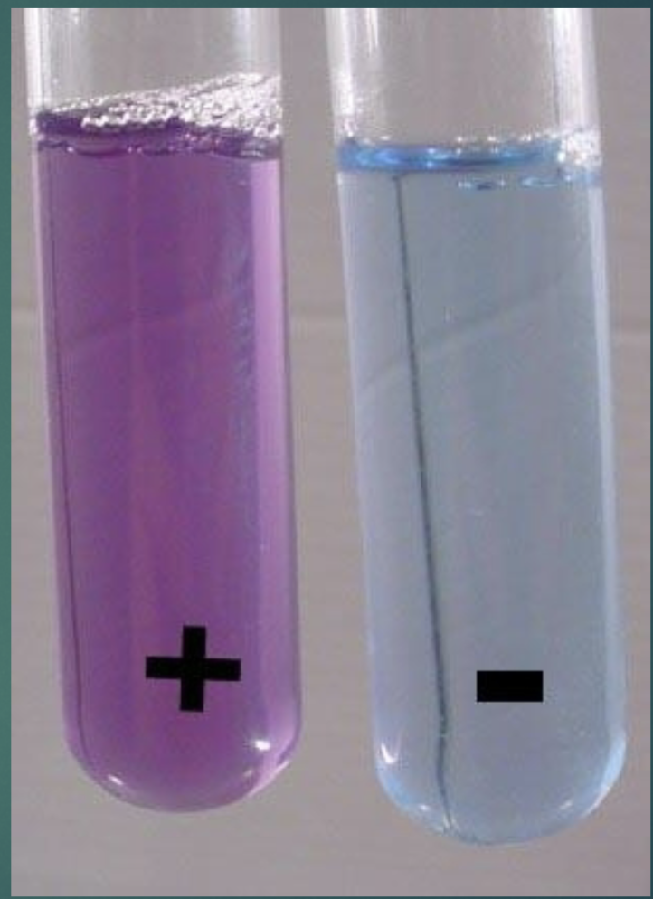 <p>Biuret’s Test:</p><ul><li><p>Albumin pos (+): purple</p></li><li><p>Albumin neg (-): blue</p></li></ul><p></p>