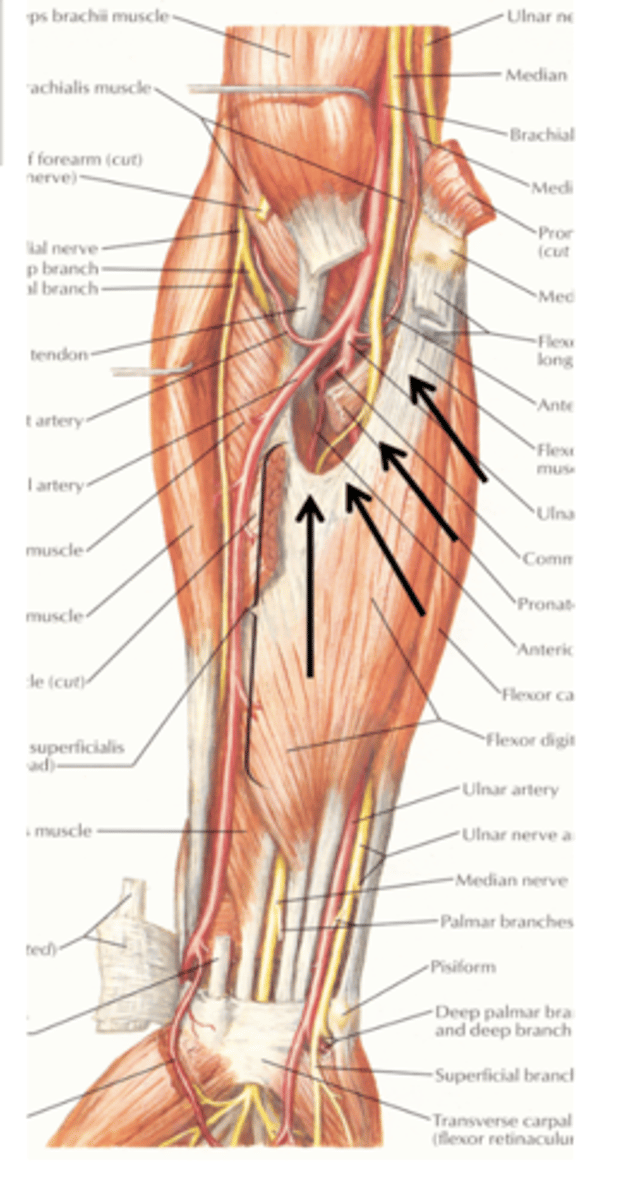<p>deep to the arch of flexor digitorum superficialis muscle</p><p>with the ulnar artery </p>