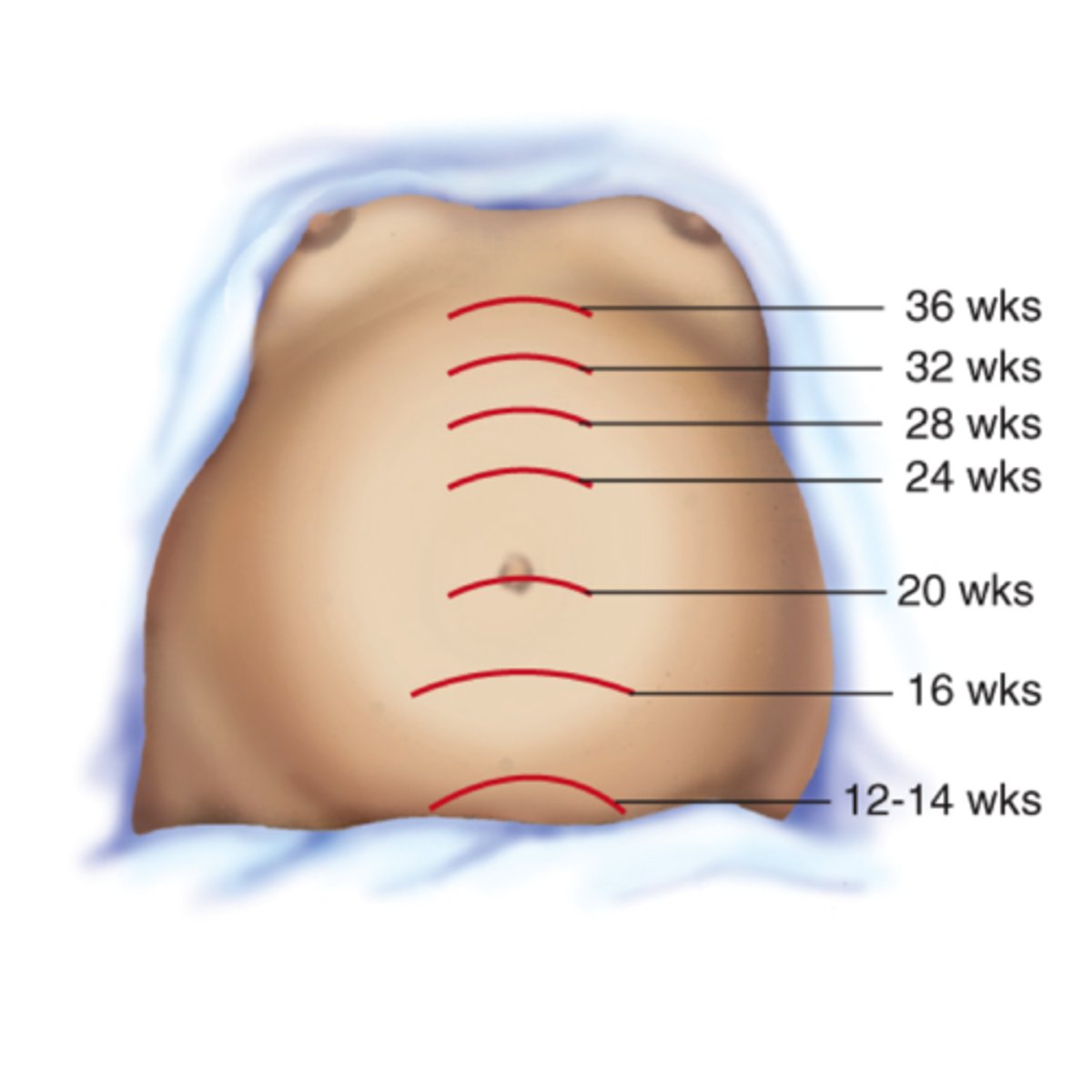 <p>Midway between the umbilicus and pubic symphysis</p>