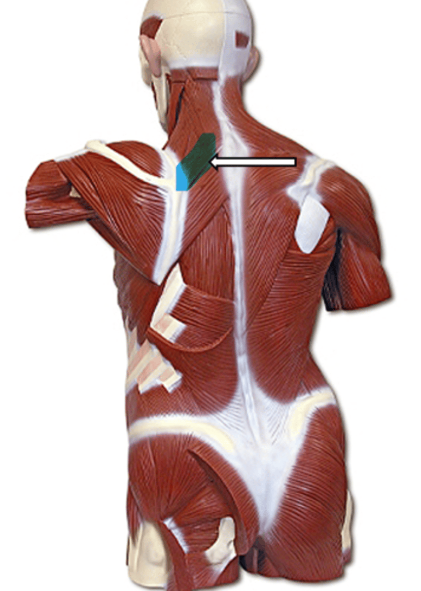 <p>name the muscle</p>