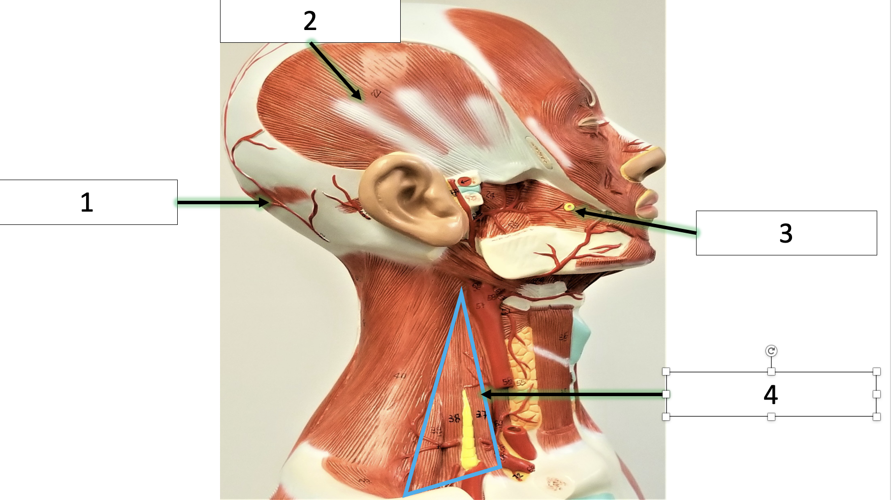 <p>name the group of muscles (4)</p>