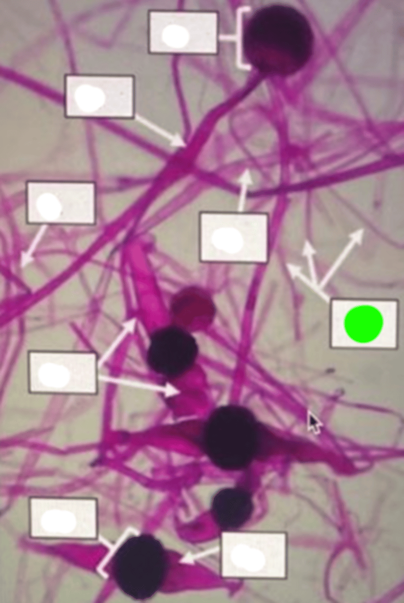 <p>Thread-like structures anchoring the fungus to substrates for support and absorption of water and nutrients. Stem-like</p>