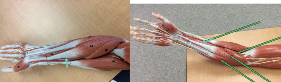 <p>Identify this muscle?</p>