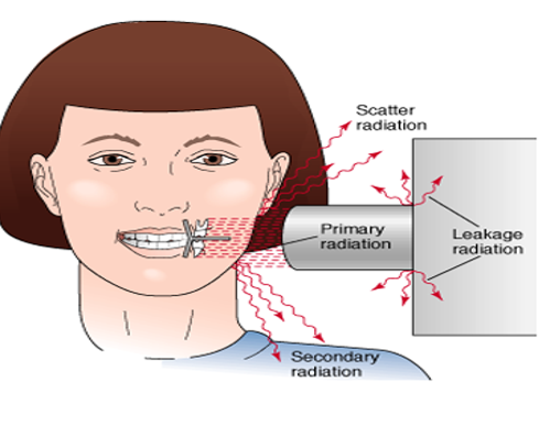 <p>secondary radiation</p>