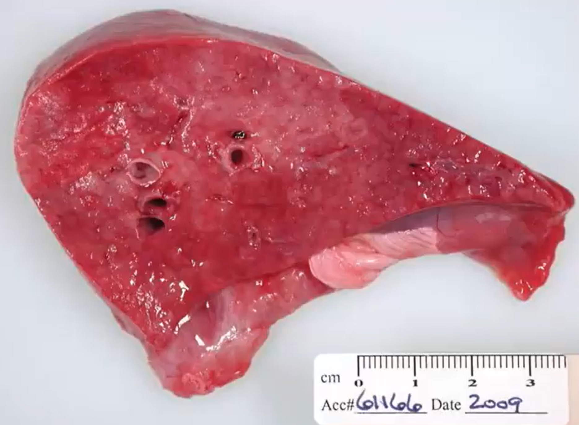 <p>Goat. MDX, cause, and name 2 other possible lesions. </p>