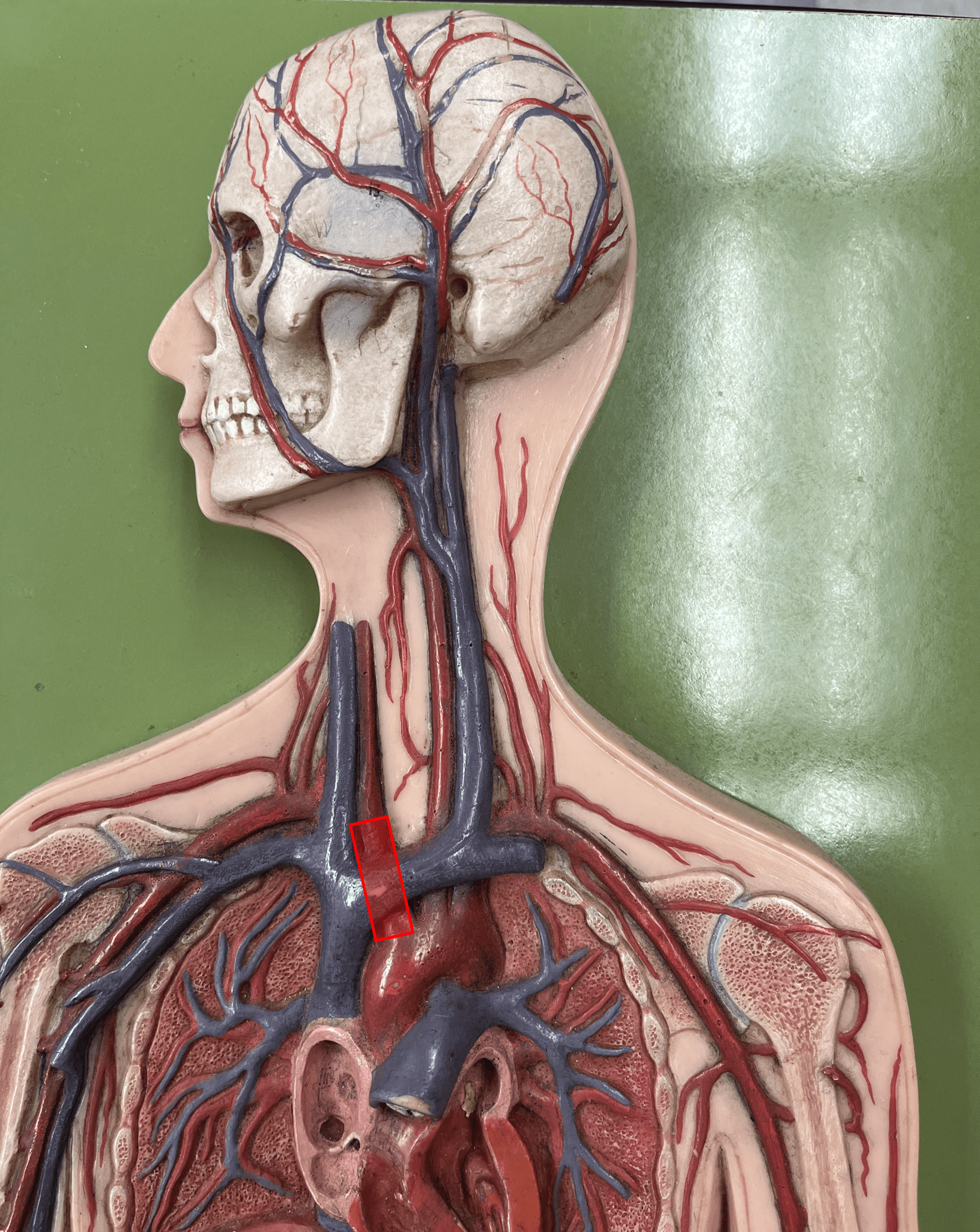 <p>• An artery of the thorax.</p>
<p>• Originates from the aortic arch.</p>
<p>• Supplies its branches: the R. subclavian and R. common carotid arteries.</p>