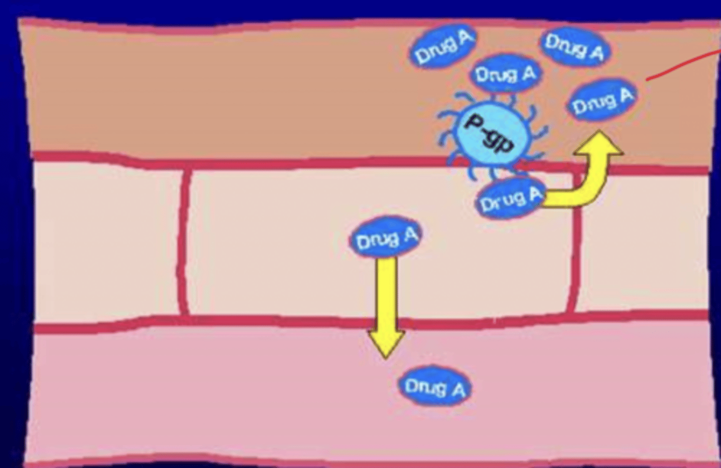 <p>- drug A will reach the intestinal wall, but P-gp will pump it back into the intestinal lumen</p><p>- most of it cannot reach the plasma to enter bloodstream and travel to its target organ</p>