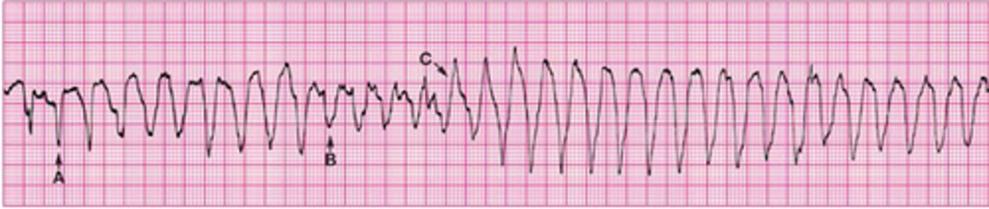 knowt flashcard image