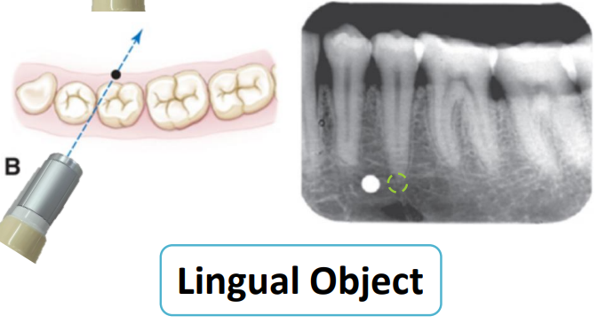 <p>mesial </p>