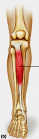 <ul><li><p>origin: tibia</p></li><li><p>insertion: tarsal bone</p></li><li><p>action: dorsiflexion</p></li></ul><p></p>