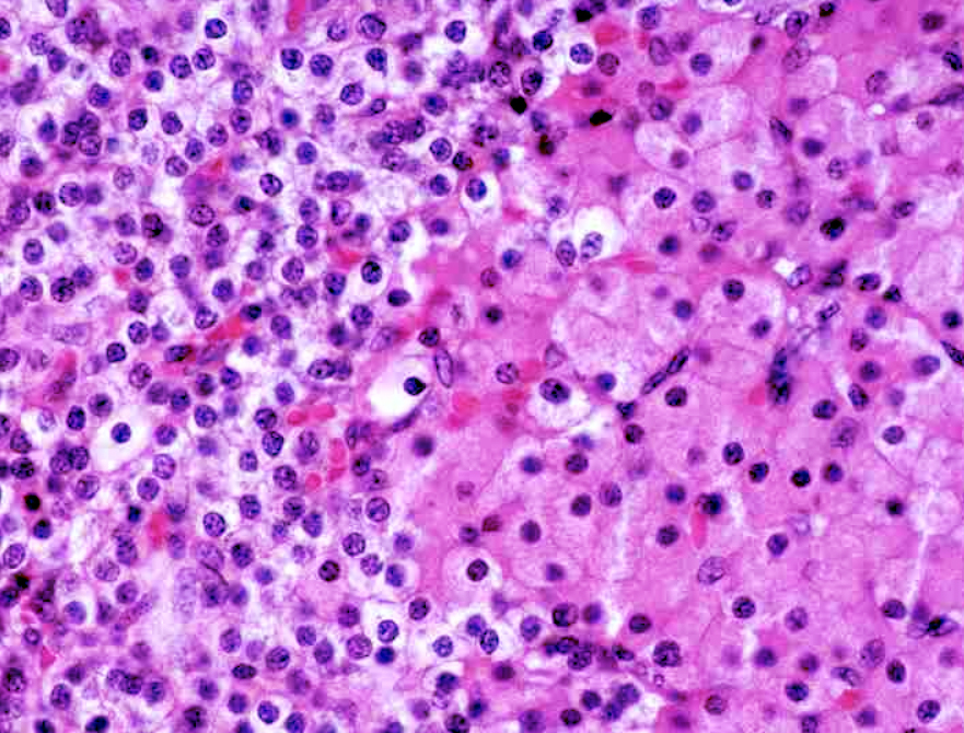 <p><span style="font-size: large">Observe the histological pattern of this specimen and select the correct identification from the list.</span></p><p><span style="font-size: large">a) adrenal gland</span></p><p><span style="font-size: large">b) thyroid gland</span></p><p><span style="font-size: large">c) pituitary gland</span></p><p><span style="font-size: large">d) parathyroid gland</span></p><p><span style="font-size: large">e) pancreas</span></p>
