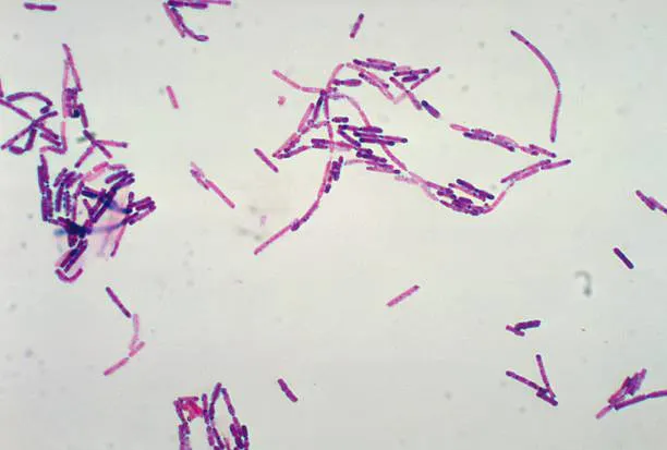 <p>(2) What shape is this bacteria?</p>