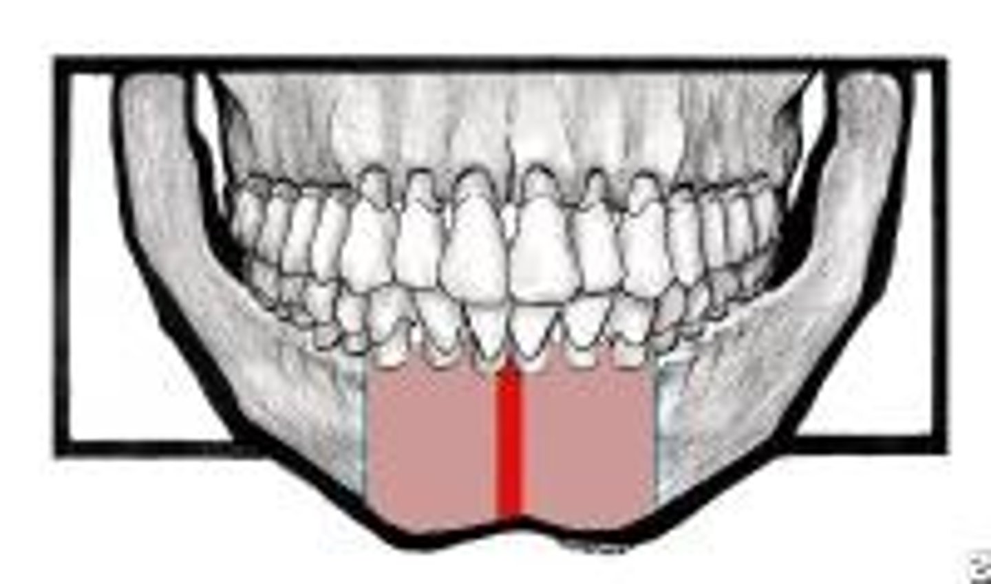 <p>where mandible formed by fusion of right and left processes</p>