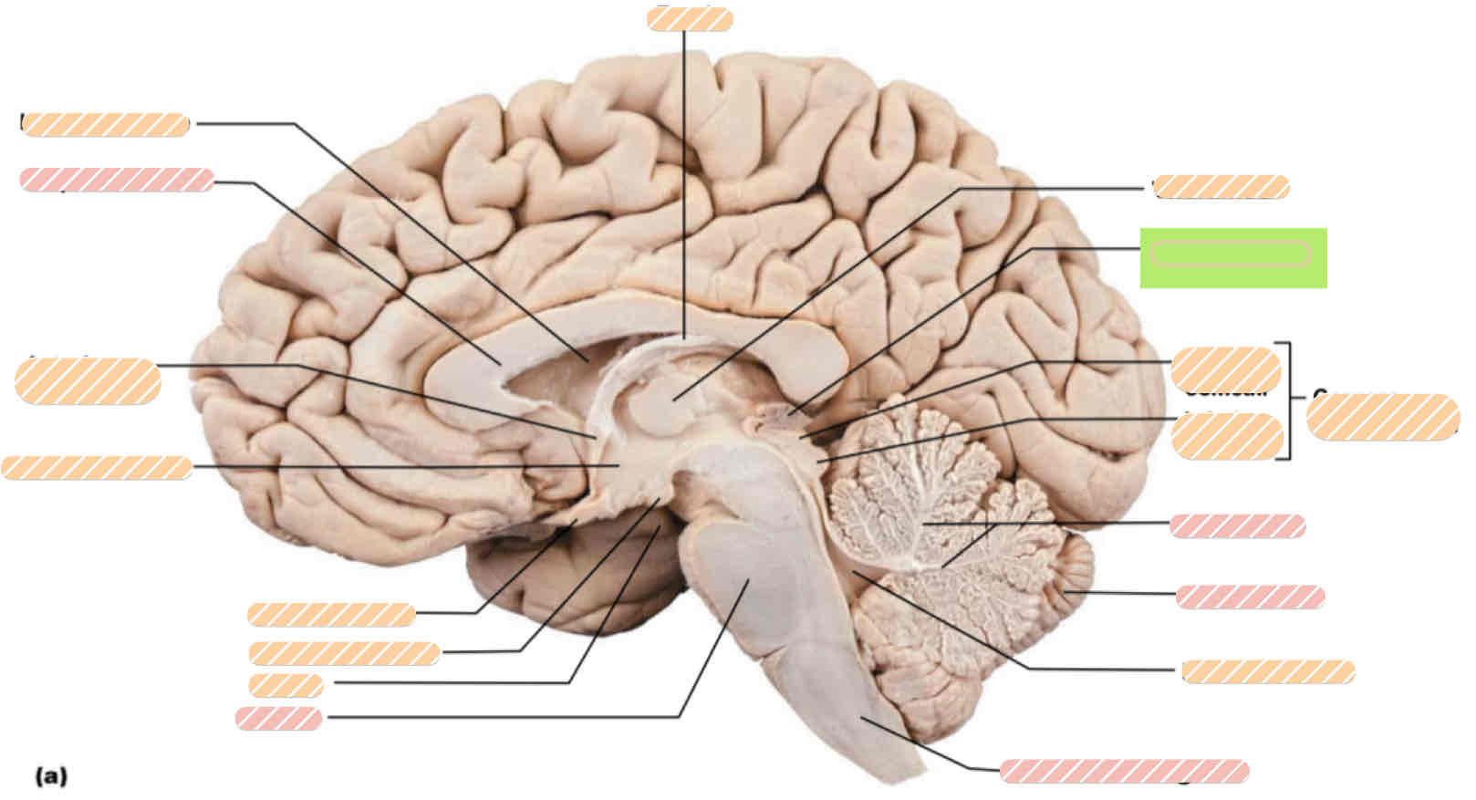 <p><span>Human brain</span></p>