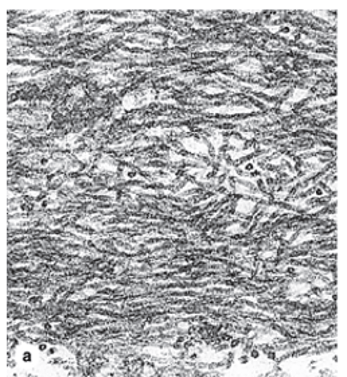 <p>Which cells secrete elastic fibers? (2)</p>