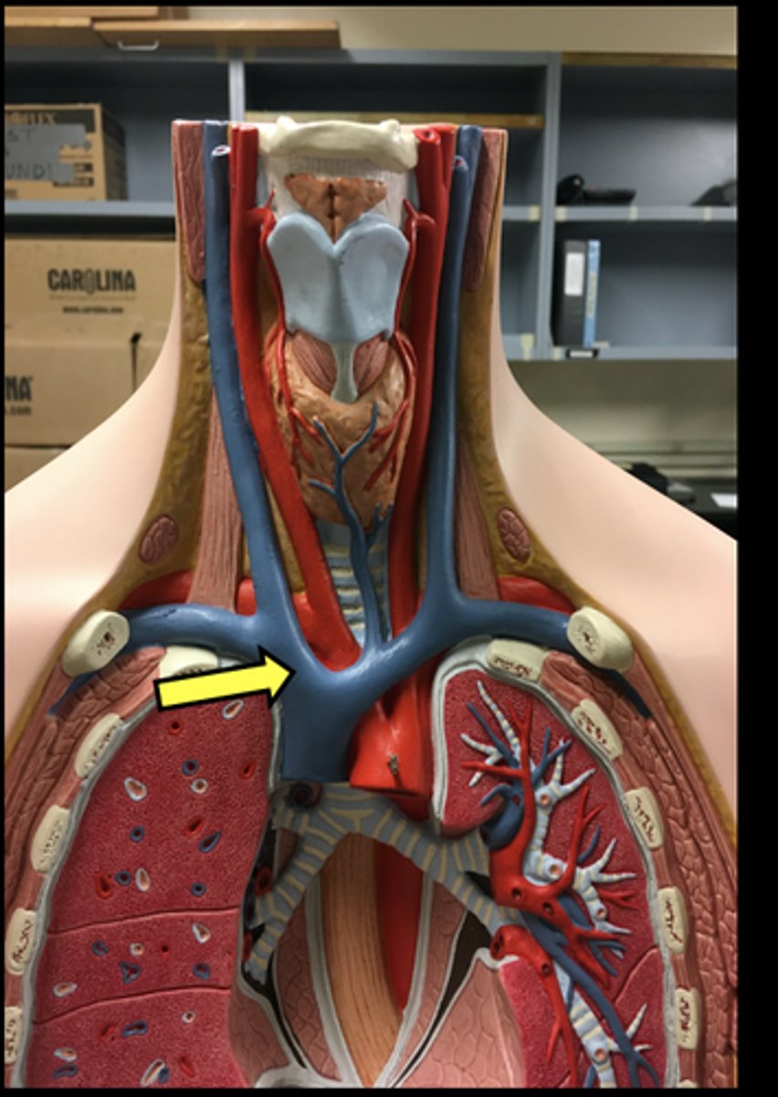 <p>**UPDATED PICTURE**</p>