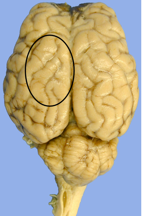 <p>parietal lobe</p>