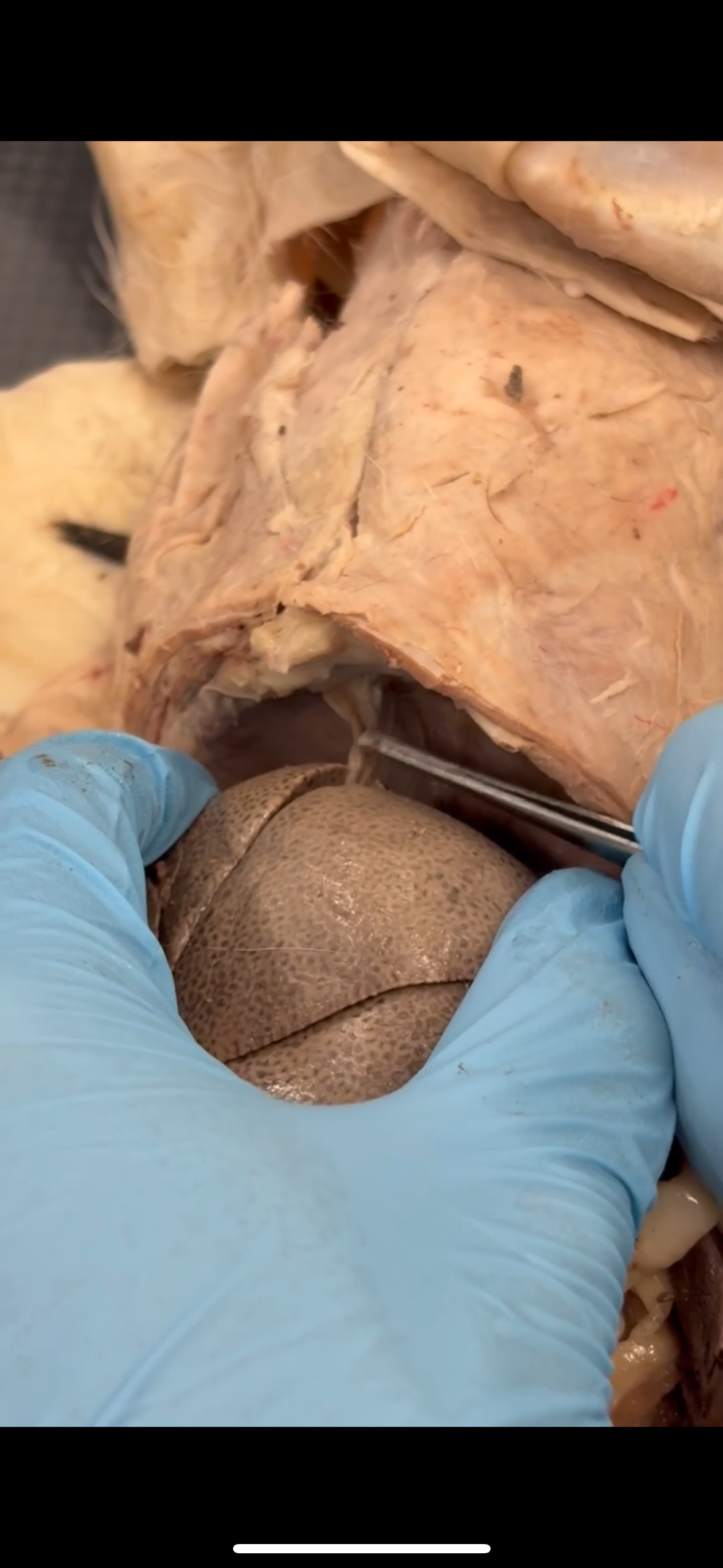 <p>Thick front ligament? (answer format: X ligament of Y)</p>