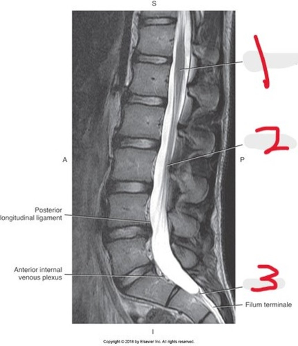 <p>Name all numbered structures</p>