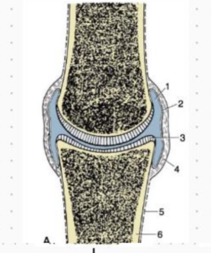 <p>surfaces articulaires des os épais par une cavité synoviale permettant le glissement grace au liquide synovial. Tres mobile : membres et articulation temporo-mandibulaire.</p>