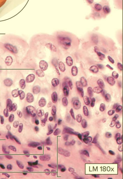 <p>What type of tissue?</p>