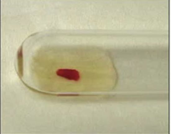 <p>Haemagglutination reaction</p>