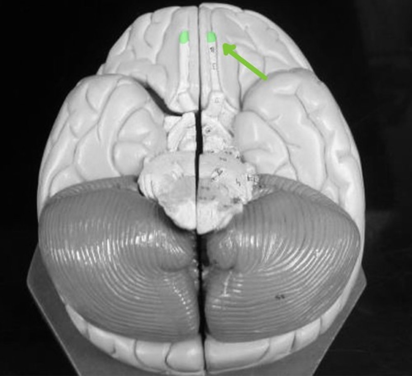 <p>Transmits OLFACTORY (smell) information to the brain.</p>