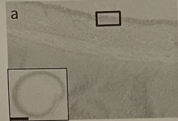<p>9.What apical specialization does this epithelium exhibit?</p><p>A. Microvilli</p><p>B. Keratin</p><p>C. Stereocilia</p><p>D. Cilia</p>